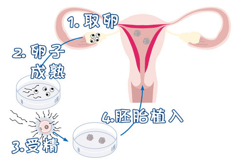 生殖医学中心